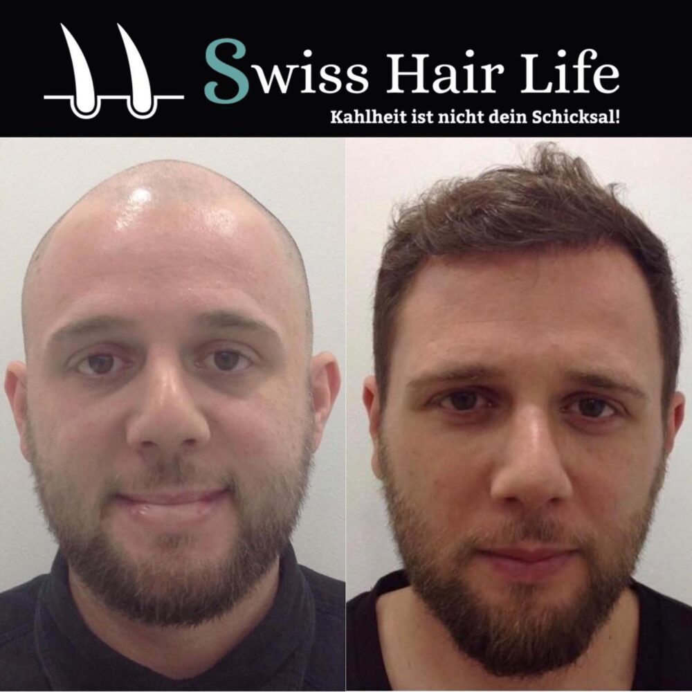 Swiss Hair Life 1
